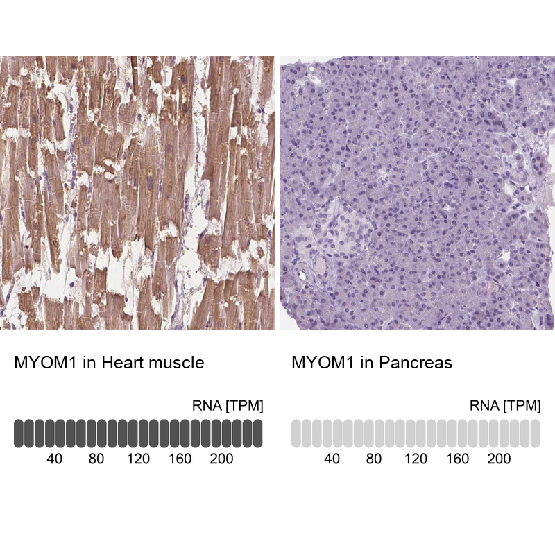 Anti-MYOM1 Antibody