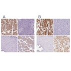 Immunohistochemical staining of human heart muscle, pancreas, prostate and skeletal muscle using Anti-MYOM1 antibody HPA014305 (A) shows similar protein distribution across tissues to independent antibody HPA049193 (B).