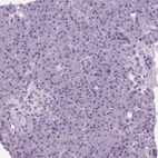 Immunohistochemical staining of human pancreas shows no positivity in exocrine glandular cells and islets of Langerhans as expected.