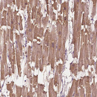 Immunohistochemical staining of human heart muscle shows strong cytoplasmic positivity in myocytes.
