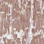 Immunohistochemical staining of human heart muscle shows strong cytoplasmic positivity in myocytes.