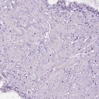 Immunohistochemical staining of human prostate shows no positivity in smooth muscle cells as expected.
