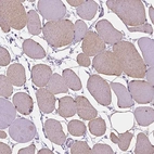 Immunohistochemical staining of human skeletal muscle shows moderate cytoplasmic positivity in myocytes.