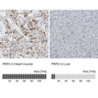 Anti-PKP2 Antibody