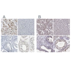 Immunohistochemical staining of human heart muscle, liver, prostate and testis using Anti-PKP2 antibody HPA014314 (A) shows similar protein distribution across tissues to independent antibody HPA056908 (B).