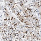 Immunohistochemical staining of human heart muscle shows strong positivity of intercalated discs.