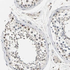 Immunohistochemical staining of human testis shows moderate nuclear positivity in cells in seminiferous ducts.