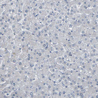 Anti-PKP2 Antibody