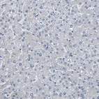 Immunohistochemical staining of human liver shows no positivity in hepatocytes as expected.