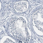 Immunohistochemical staining of human prostate shows low positivity in glandular cells as expected.