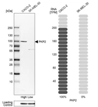 Western blot analysis in human cell lines Caco-2 and SK-MEL-30 using Anti-PKP2 antibody. Corresponding PKP2 RNA-seq data are presented for the same cell lines. Loading control: Anti-GAPDH.