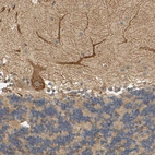 Immunohistochemical staining of human cerebellum shows strong cytoplasmic positivity in Purkinje cells.