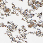 Immunohistochemical staining of human lung shows strong cytoplasmic/ membranous positivity in macrophages.
