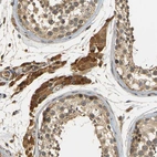Immunohistochemical staining of human testis shows strong cytoplasmic positivity in Leydig cells.