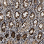 Immunohistochemical staining of human rectum shows moderate cytoplasmic positivity in glandular cells.