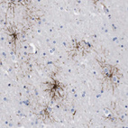 Anti-FAM210A Antibody