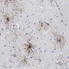 Anti-FAM210A Antibody