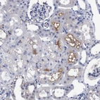 Immunohistochemical staining of human kidney shows moderate membranous positivity in cells in tubules.