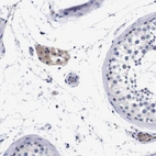 Immunohistochemical staining of human testis shows moderate cytoplasmic positivity in Leydig cells.