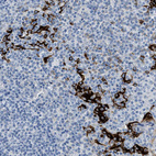 Immunohistochemical staining of human tonsil shows strong cytoplasmic positivity in squamous epithelial cells.