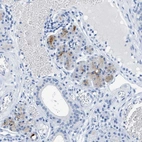 Immunohistochemical staining of human salivary gland shows moderate cytoplasmic positivity in a subset of glandular cells.