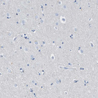 Immunohistochemical staining of human cerebral cortex shows no cytoplasmic positivity in neuronal cells as expected.