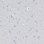 Immunohistochemical staining of human cerebral cortex shows no cytoplasmic positivity in neuronal cells as expected.