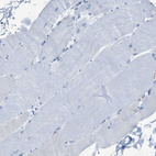Immunohistochemical staining of human skeletal muscle shows no cytoplasmic positivity in myocytes as expected.