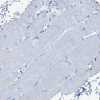 Immunohistochemical staining of human skeletal muscle shows no cytoplasmic positivity in myocytes as expected.