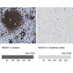 Anti-MS4A1 Antibody