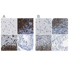 Immunohistochemical staining of human cerebral cortex, lymph node, spleen and testis using Anti-MS4A1 antibody HPA014341 (A) shows similar protein distribution across tissues to independent antibody HPA014391 (B).
