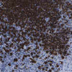 Immunohistochemical staining of human tonsil shows strong membranous positivity in germinal center cells.