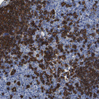 Immunohistochemical staining of human lymph node shows strong membranous positivity in germinal center cells.