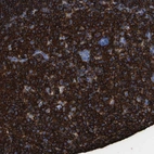 Immunohistochemical staining of human tonsil shows strong membranous positivity in germinal center cells.