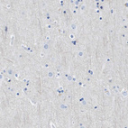 Immunohistochemical staining of human cerebral cortex shows low expression as expected.
