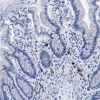 Immunohistochemical staining of human gastrointestinal shows strong membranous positivity in lymphocytes.
