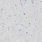Immunohistochemical staining of human cerebral cortex shows low expression as expected.