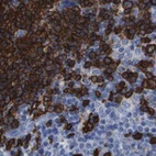 Immunohistochemical staining of human lymph node using Anti-MS4A1 antibody HPA014341.