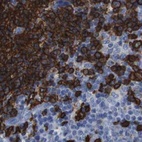 Anti-MS4A1 Antibody