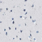 Immunohistochemical staining of human cerebral cortex using Anti-MS4A1 antibody HPA014341.
