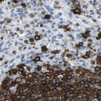 Immunohistochemical staining of human spleen using Anti-MS4A1 antibody HPA014341.