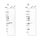 Anti-MS4A1 Antibody