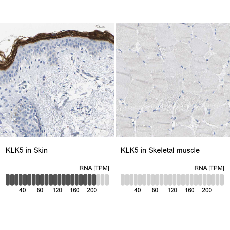 Anti-KLK5 Antibody