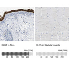 Anti-KLK5 Antibody