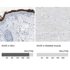 Anti-KLK5 Antibody