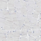 Immunohistochemical staining of human skeletal muscle shows low expression as expected.