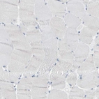 Immunohistochemical staining of human skeletal muscle shows low expression as expected.