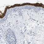 Immunohistochemical staining of human skin shows high expression.
