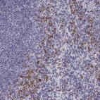 Anti-MILR1 Antibody