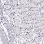 Immunohistochemical staining of human stomach shows low expression as expected.